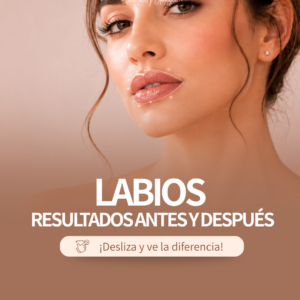 Tratamiento de labios con la Dra Perez George