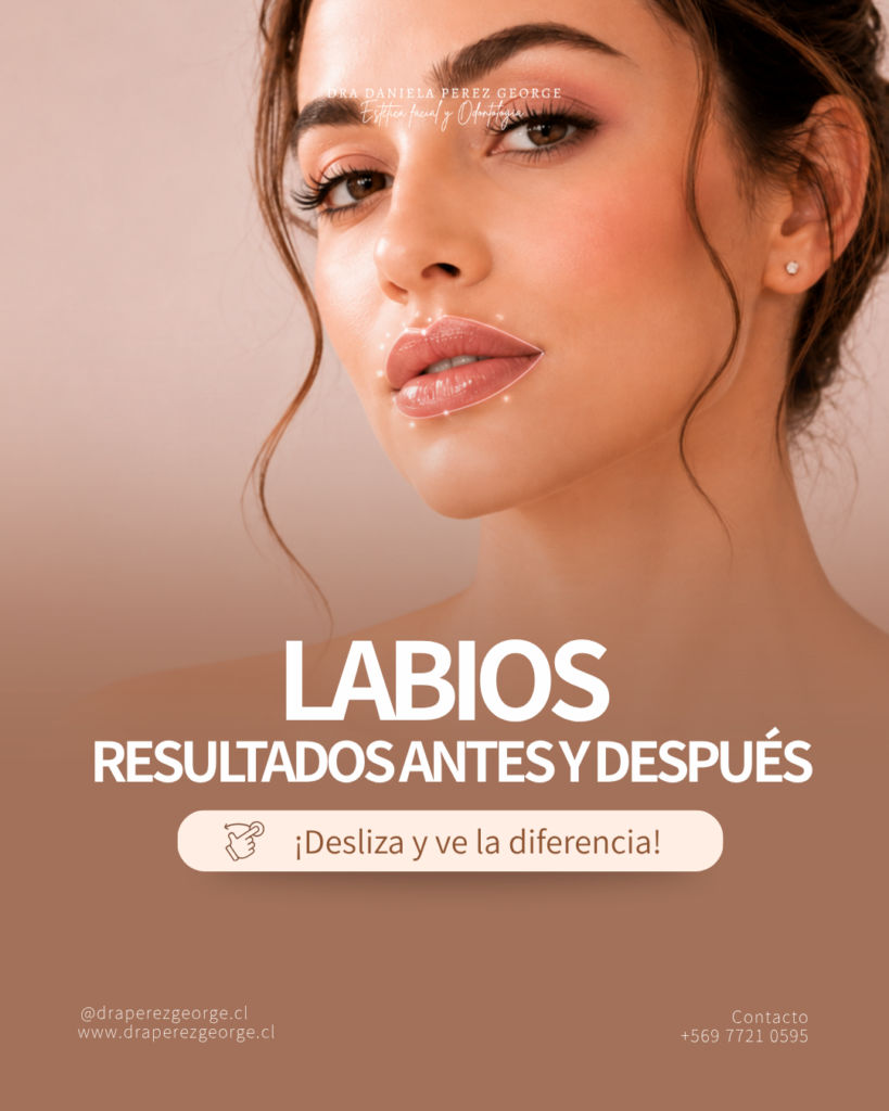Tratamiento de labios con la Dra Perez George